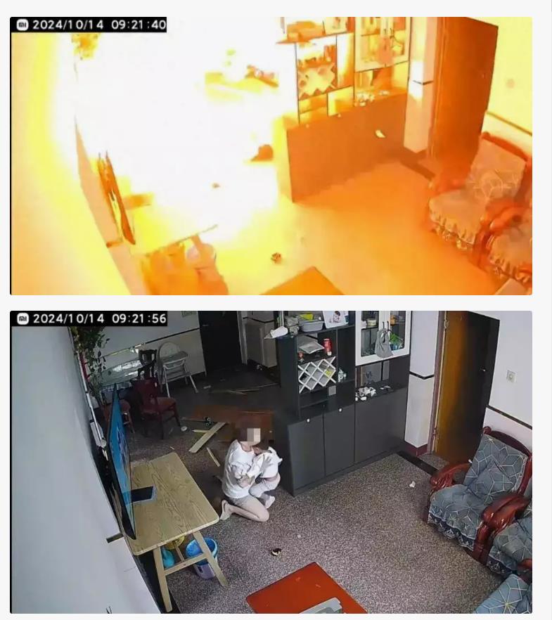“烧伤妈妈”钢丝球清创收到超百万捐款